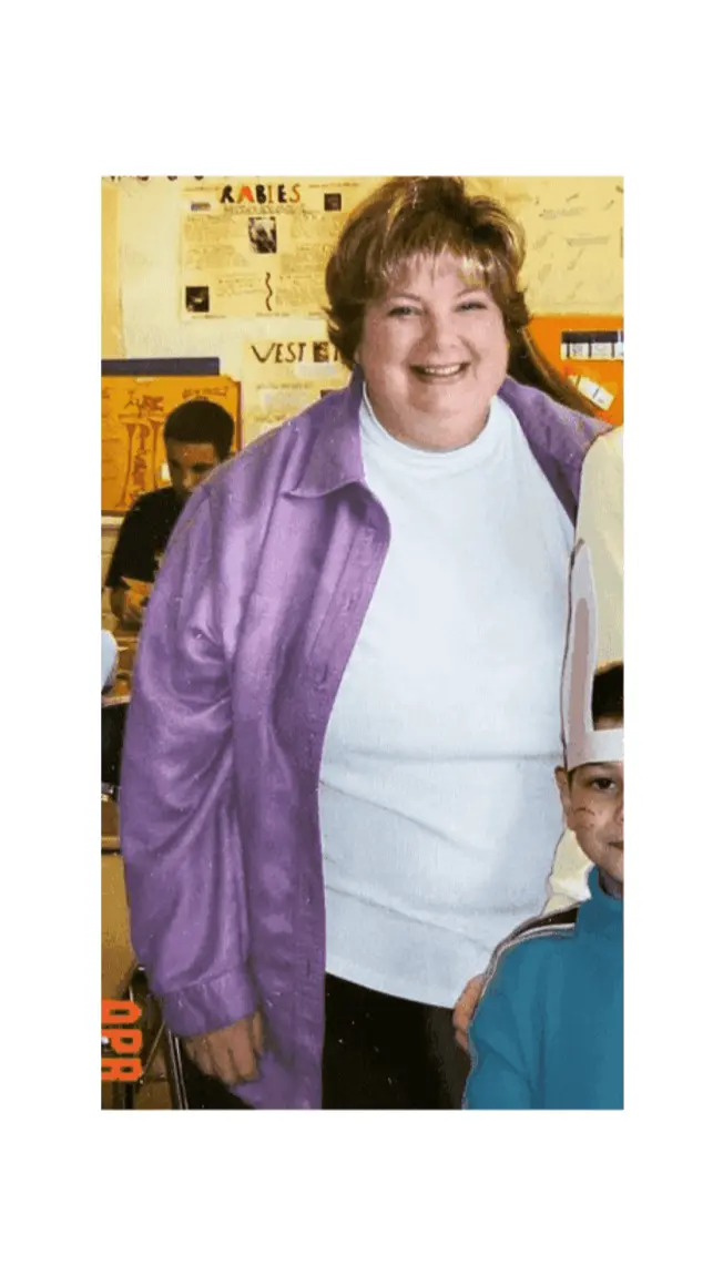 Before Purple Peel Diet
